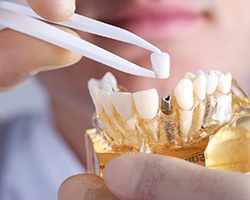 Vero Beach implant dentist holding restoration and model jaw