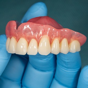 A full denture for the upper arch 