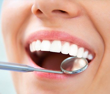 Closeup of smile during dental exam