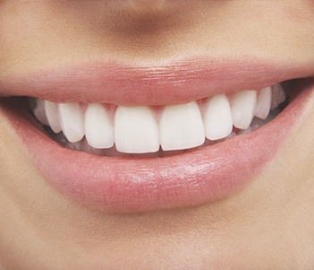 Closeup of healthy smile