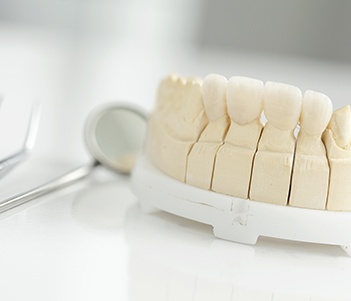 Model smile with dental restorations