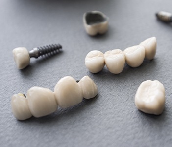 Bridges and dental crowns prior to placement