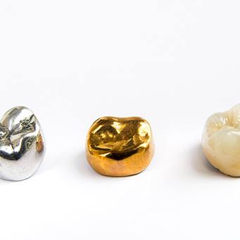 Factors that affect the cost of dental crown include the material they are made  of