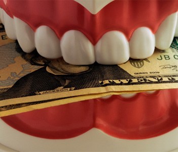 a model of dentures biting down on cash
