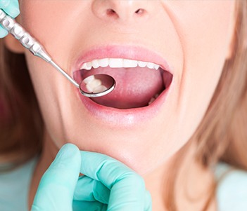 Closeup of smiling during dental exam