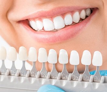 Smile cmopared with tooth color chart