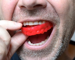 man putting mouthguard on