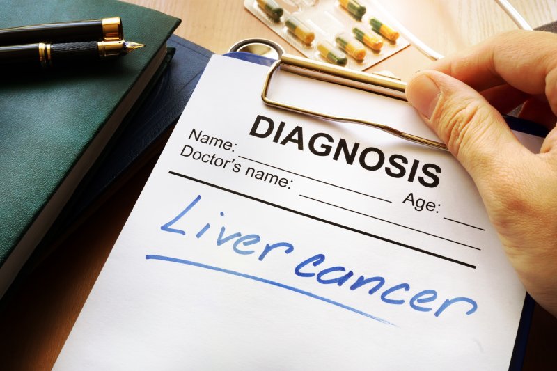 Liver Cancer