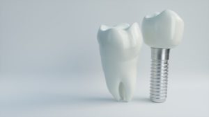 dental implant with crown next to natural tooth