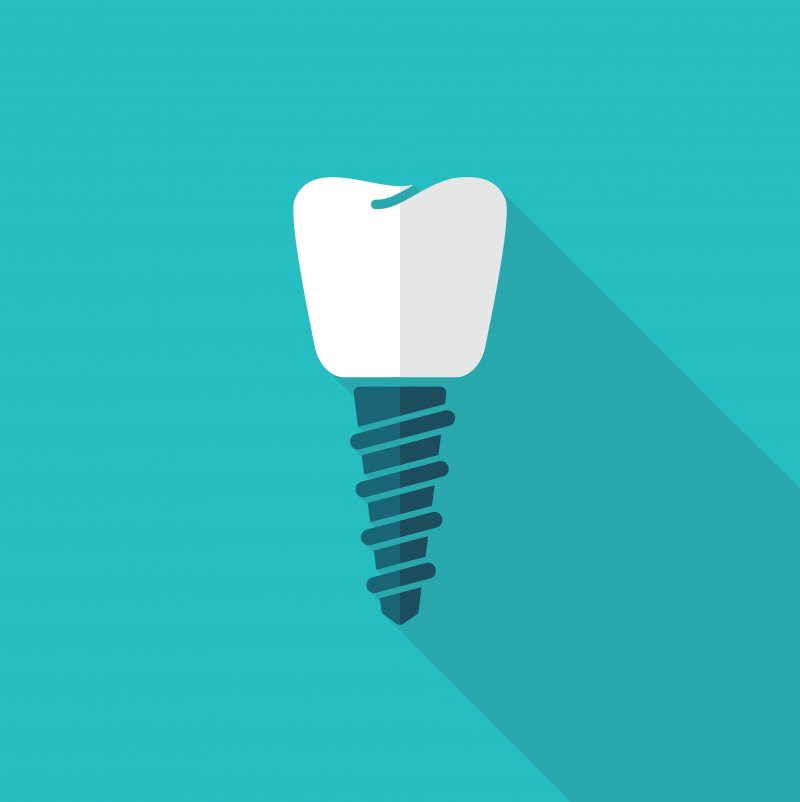 Dental implant vector illustration.