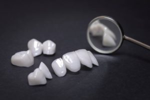 types of veneers on a dentist’s table