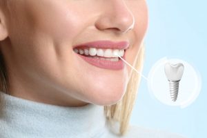 Woman with a dental implant smiling wide