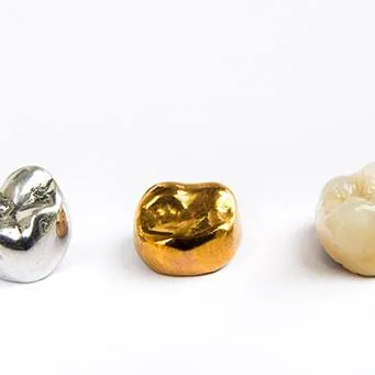 Understanding the Cost of Dental Crowns