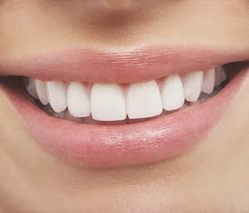 Closeup of healthy smile