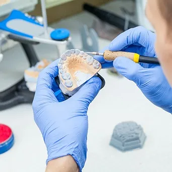 How Dentures are Made